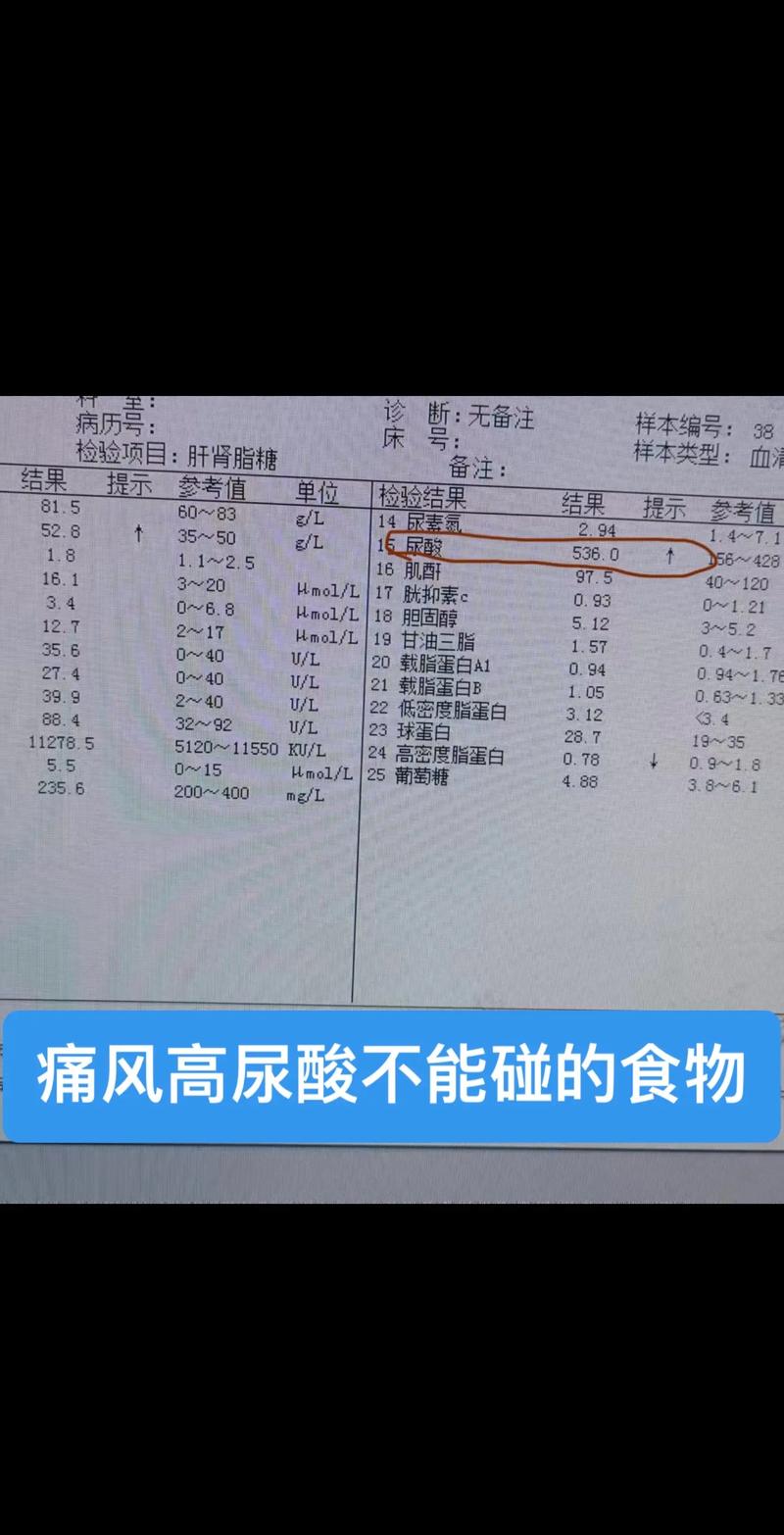 什么是尿酸盐,什么是尿酸盐沉积